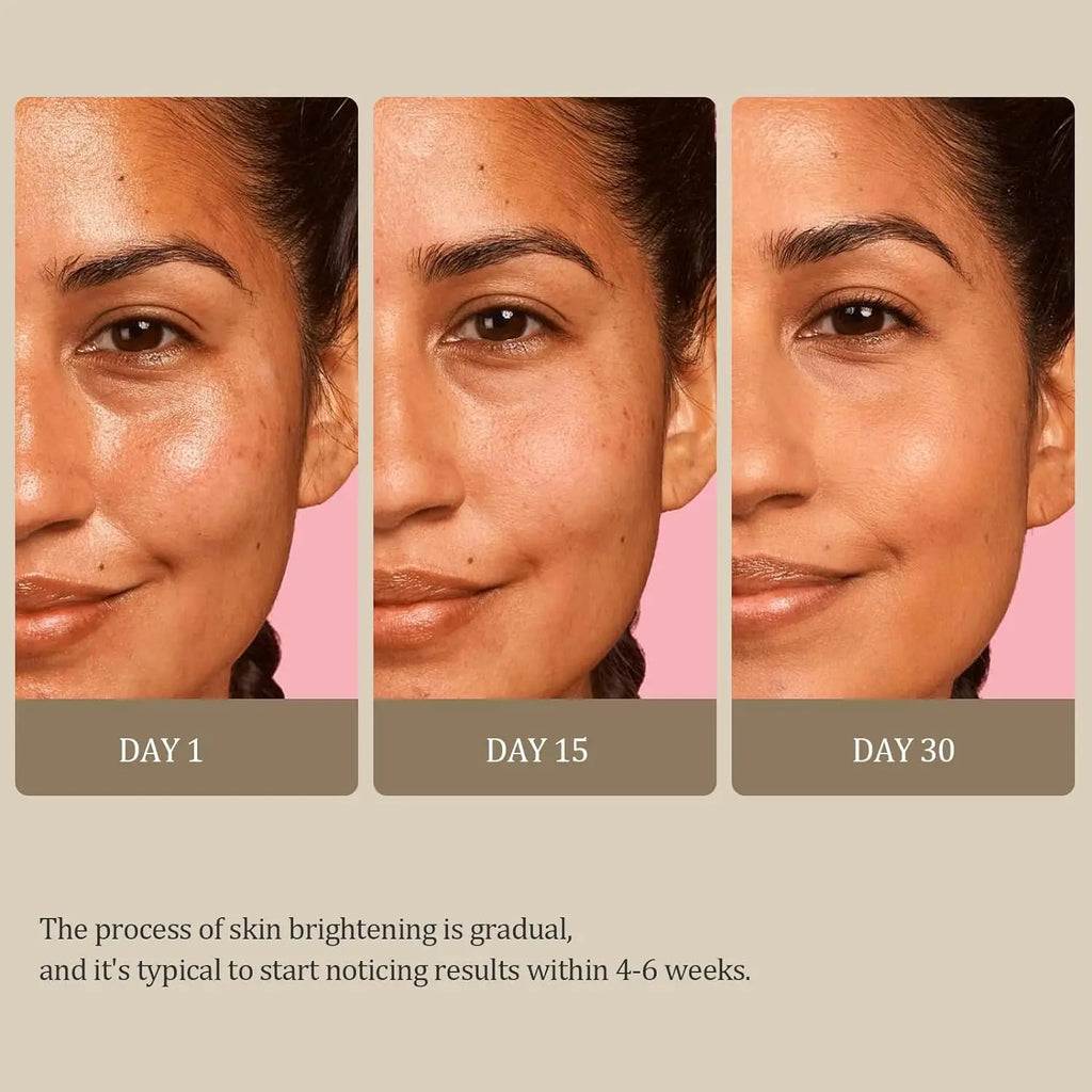 Turmeric & Kojic Acid Glow Soap – Dark Spot & Acne Removal, Even Skin Tone