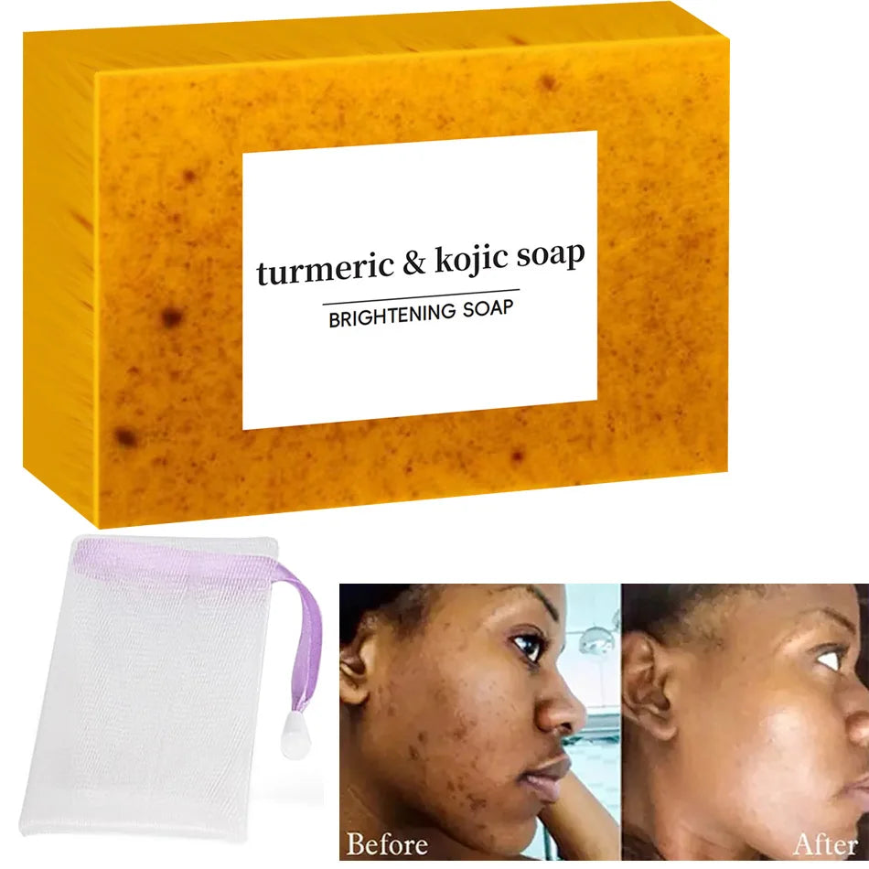 Turmeric & Kojic Acid Glow Soap – Dark Spot & Acne Removal, Even Skin Tone