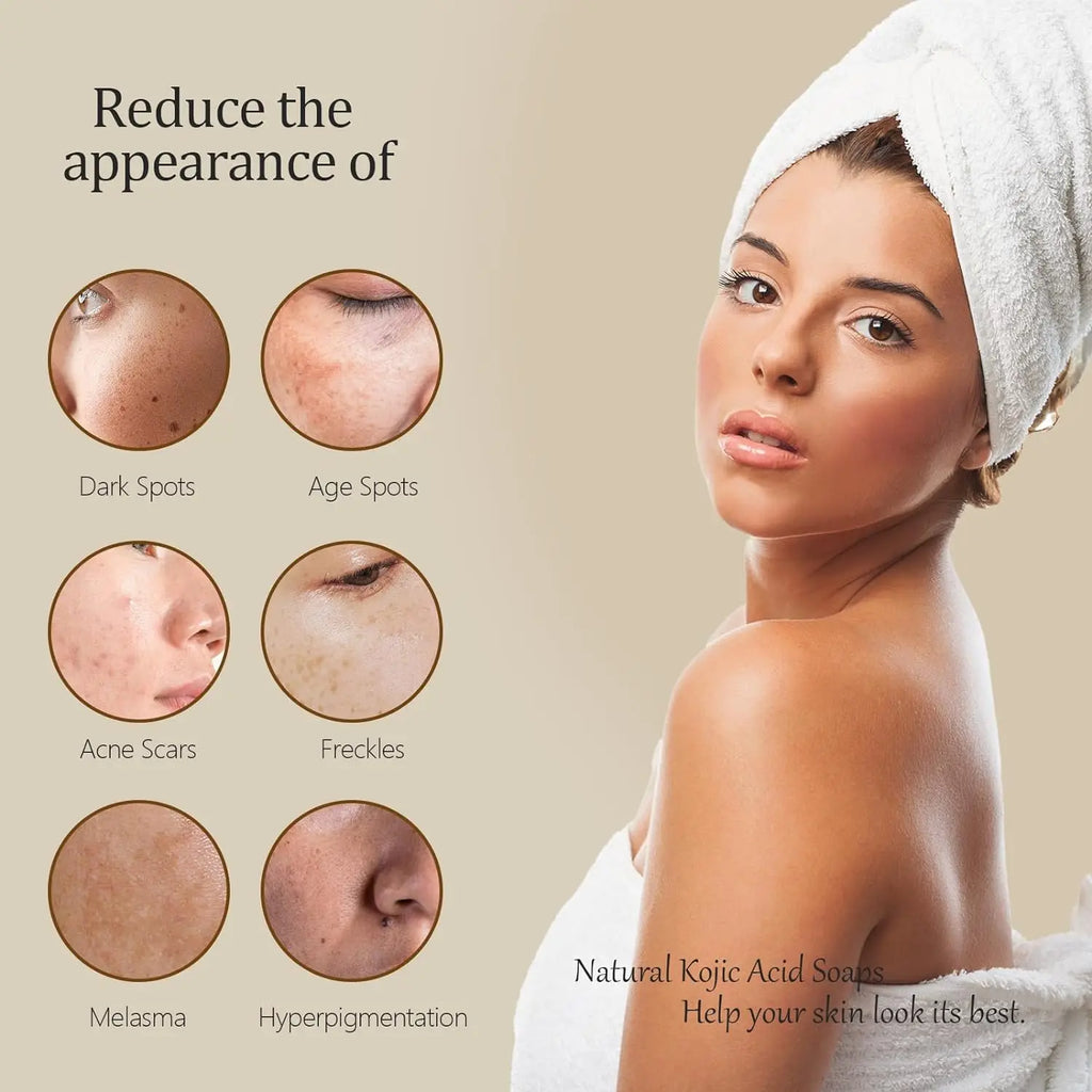 Turmeric & Kojic Acid Glow Soap – Dark Spot & Acne Removal, Even Skin Tone