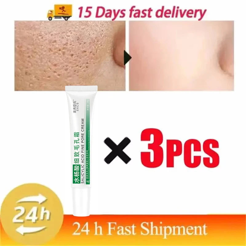 Salicylic Acid Pore Shrinking Cream – Blackhead Removal & Smooth Skin